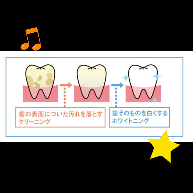 ホワイトニングとクリーニング