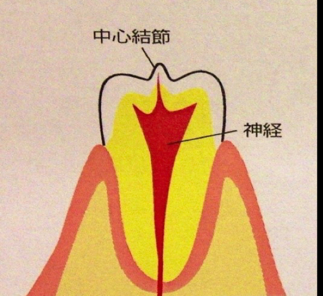 ツノのある歯