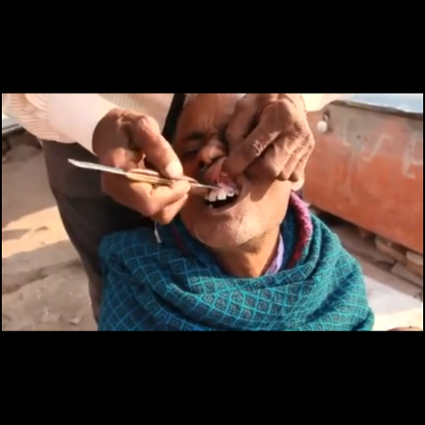 Street dentistry in India #インドの屋台歯医者さん⁈